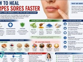 how to heal herpes sores faster