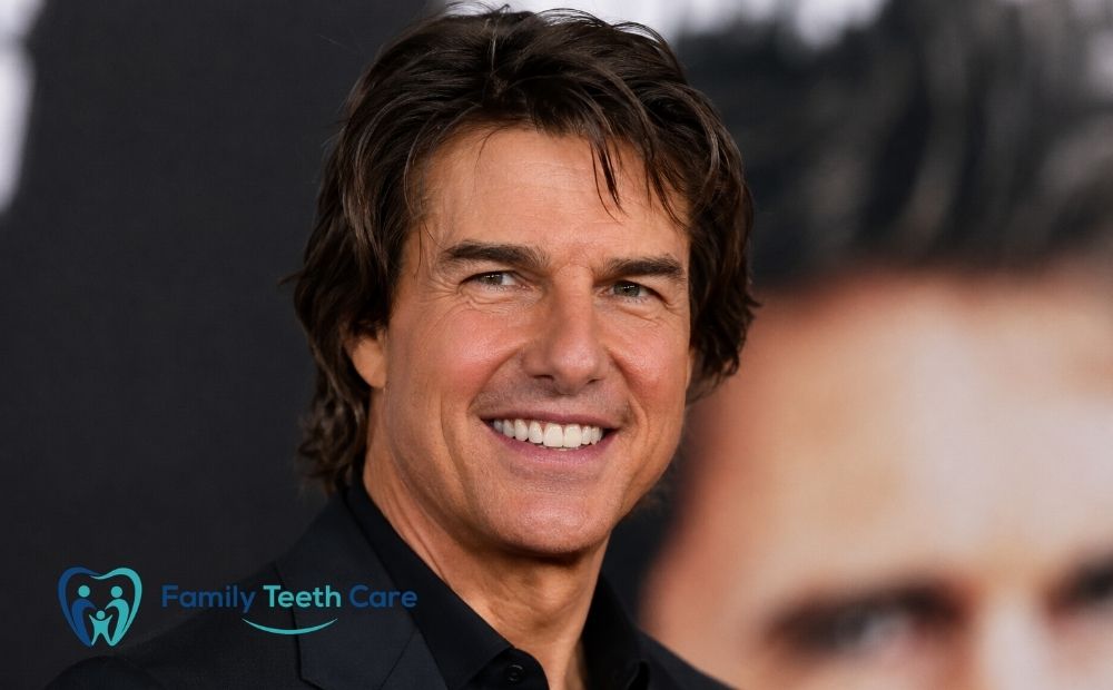 Tom Cruise Teeth