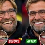 Jurgen Klopp Teeth