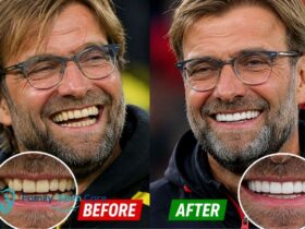 Jurgen Klopp Teeth