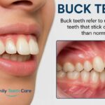 Buck Teeth