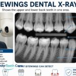 Bitewings Dental