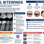 Dental Bitewings
