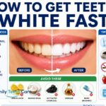 how to get teeth white fast